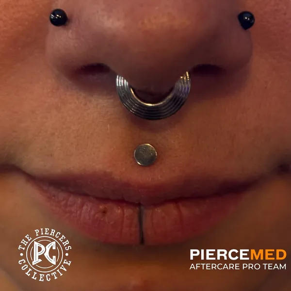 Fresh placement